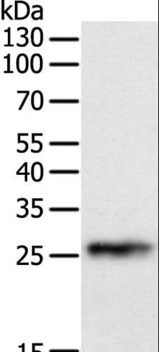Polyclonal Rabbit anti-Human CRP / C-Reactive Protein Antibody (IHC, WB)