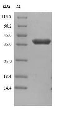 Human ANTXR1 / TEM8 Protein (Recombinant 6His, N-terminus)