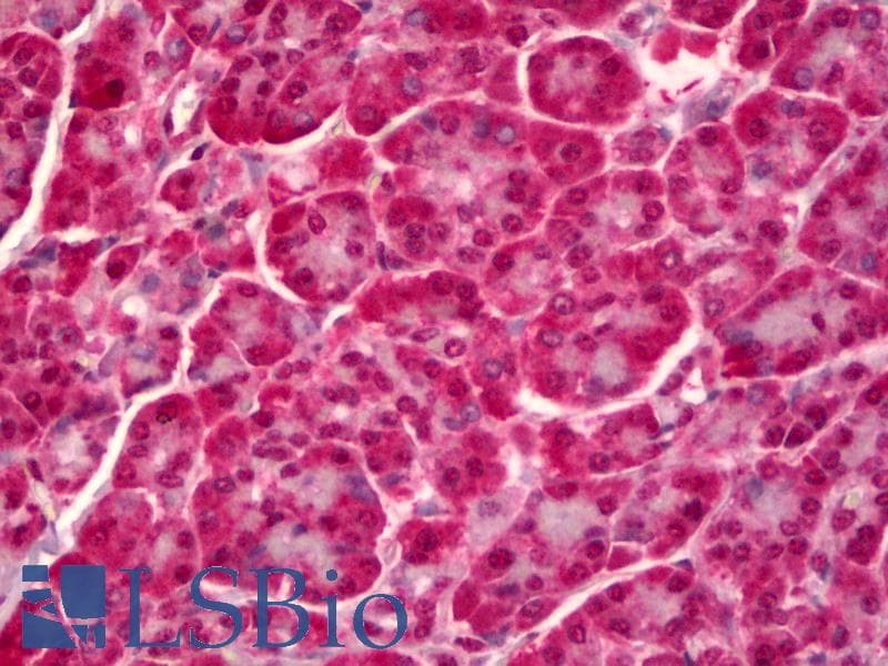 IHC-plus™ PTPN22 / PEP Antibody (clone 1A6)