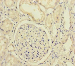 XPO6 Antibody