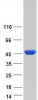 Human PSAT1 Protein (Recombinant Myc-DDK (Flag))