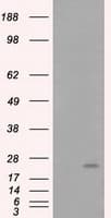 ARHGDIA / RHOGDI Antibody (clone OTI1A7)