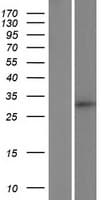Human LDLRAD4 / C18orf1 Protein (Over-Expression Lysate Myc-DDK (Flag))