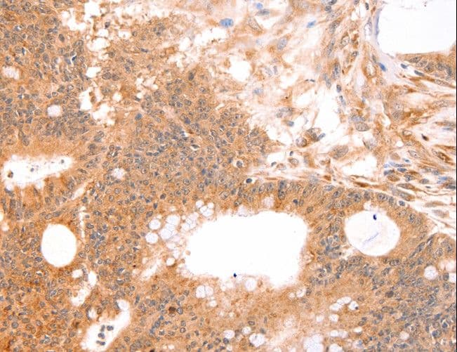 Polyclonal Rabbit anti-Human LTA / TNF Beta Antibody (IHC)