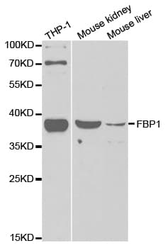 Polyclonal Rabbit anti-Human FBP1 Antibody (IF, WB)