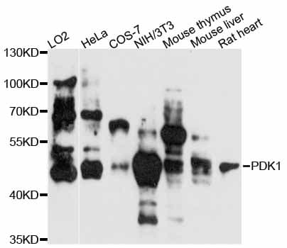 Polyclonal Rabbit anti-Human PDK1 Antibody (WB)