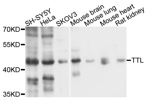 TTL Antibody