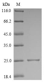Mouse IL18 Protein (Recombinant 6His, C-terminus)