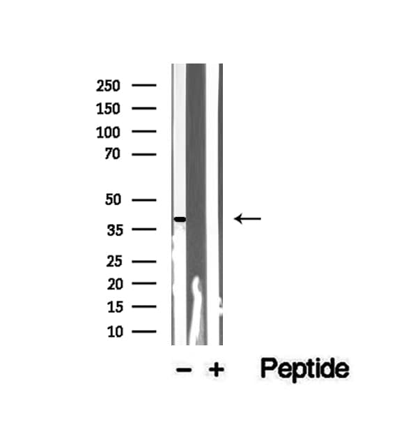 SLC7A11 / XCT Antibody