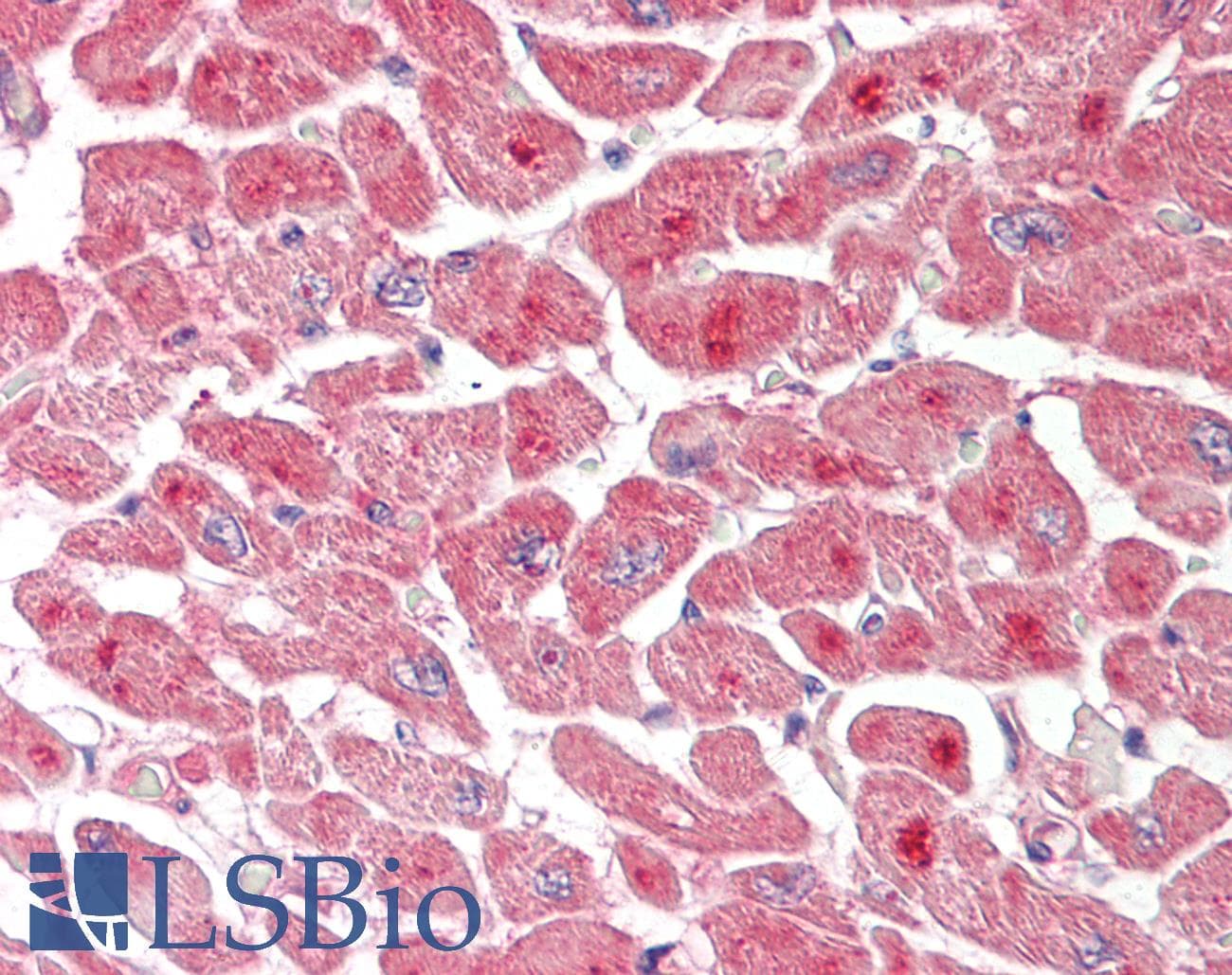 ATXN3 / JOS Antibody (aa35-84)