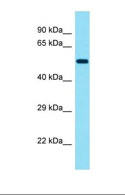 KRT78 / Keratin 78 Antibody (aa190-239)
