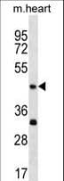 ACTL7B Antibody (aa227-253)