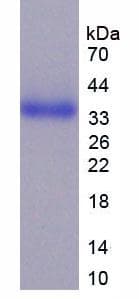Human CD24 Protein (Recombinant His-GST)