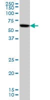 AKT1 Antibody (clone 6G6)