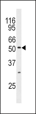 MAPK10 / JNK3 Antibody (aa1-30)