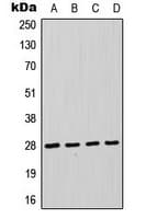 Polyclonal Rabbit anti-Human FADD Antibody (Internal, IHC, IF, WB)