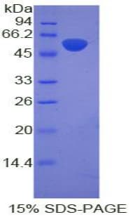 Rat POMC / Proopiomelanocortin Protein (Recombinant His-GST)