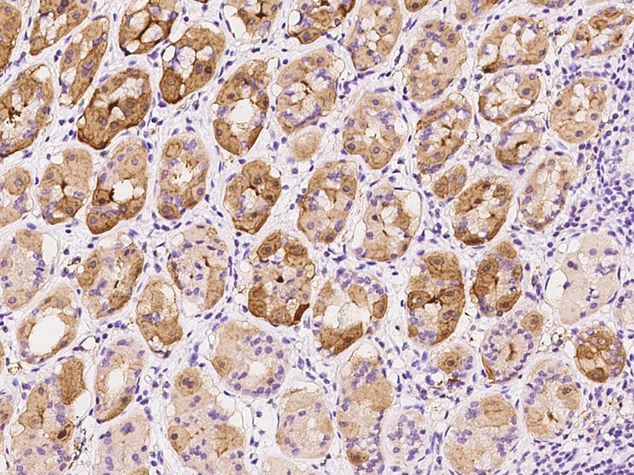 ST3GAL4 / ST3Gal IV Antibody