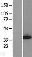 GGPS1 Protein (Over-Expression Lysate Myc-DDK (Flag))