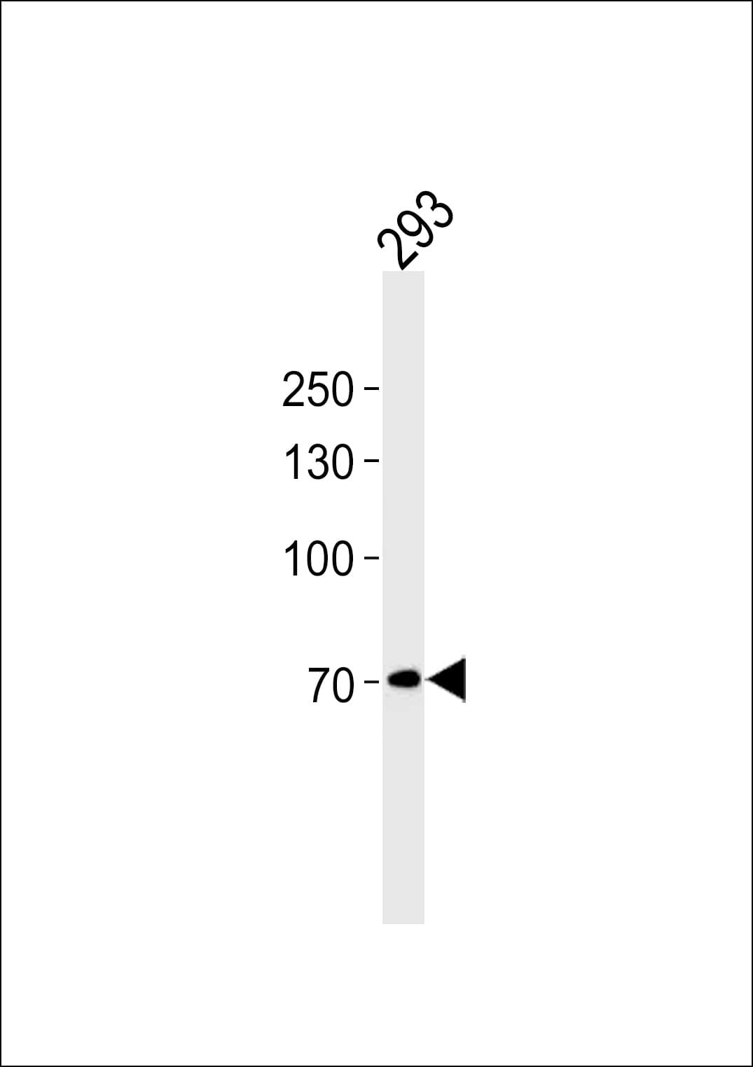 WT5 / POU6F2 Antibody (aa34-61)