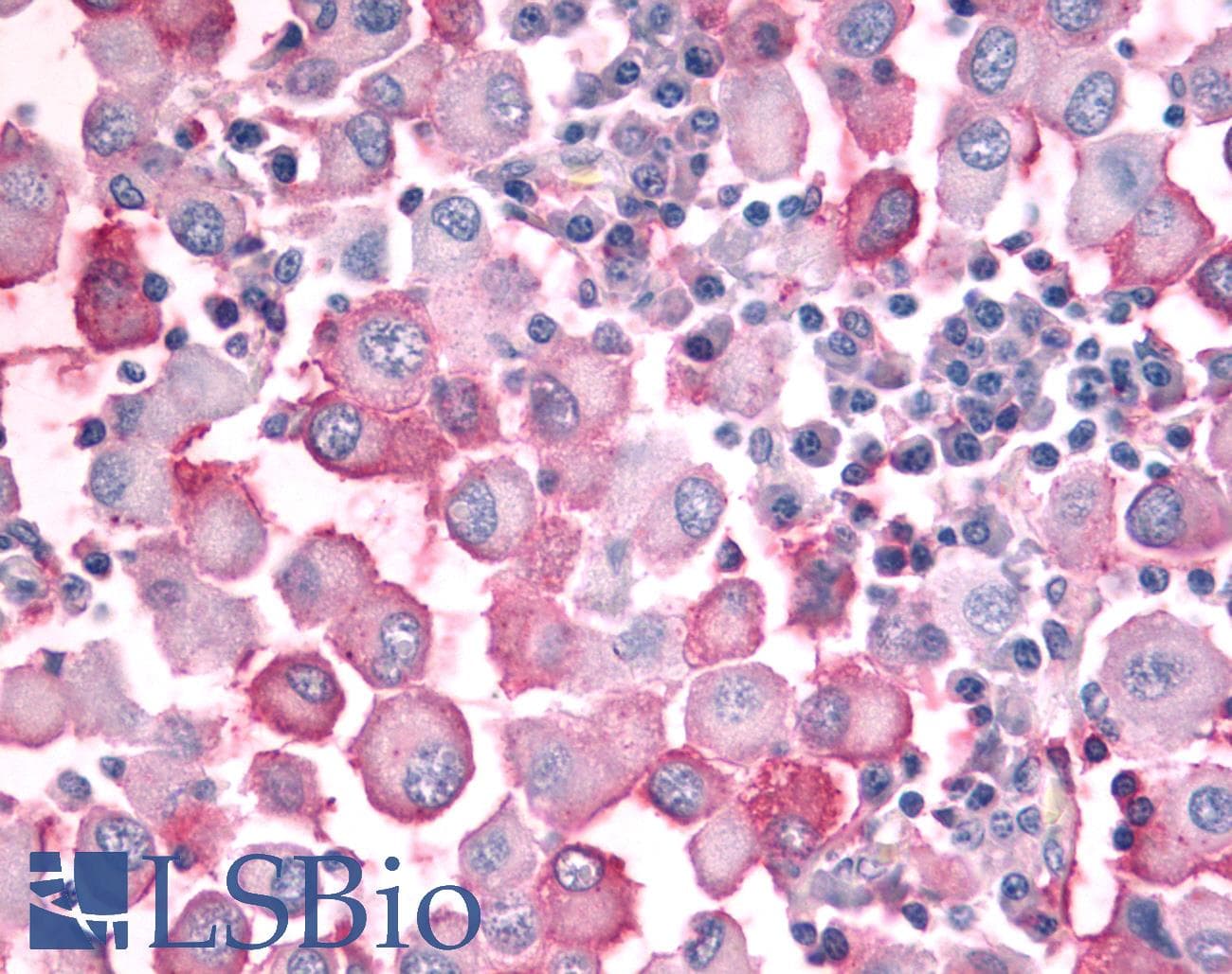 IHC-plus™ OR10J5 Antibody (Extracellular Domain)