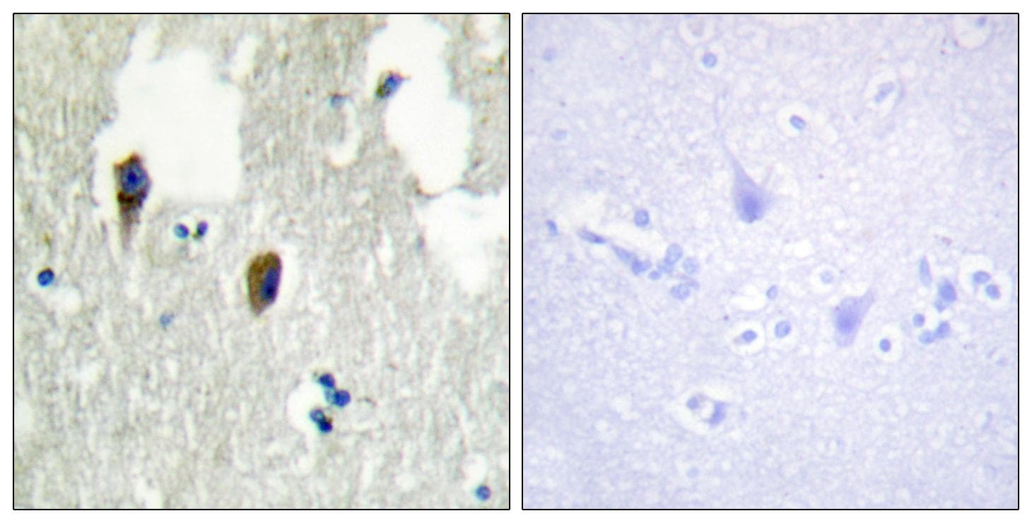 Polyclonal Rabbit anti-Human KLHL3 Antibody (IHC, IF, WB)