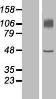 EMCN / Endomucin Protein (Over-Expression Lysate Myc-DDK (Flag))