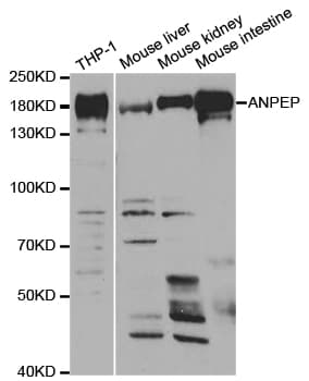 Polyclonal Rabbit anti-Human ANPEP / CD13 Antibody (IHC, WB)