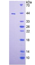Mouse ADAM8 Protein (Recombinant His, N-Terminal)