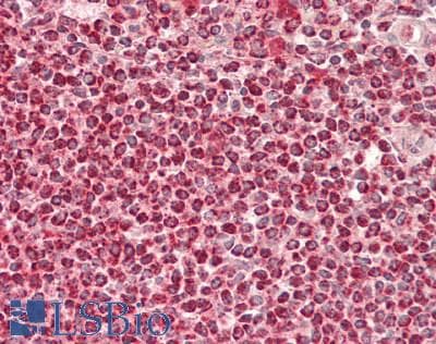 IHC-plus™ LTBR Antibody