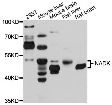 NADK / NAD Kinase Antibody