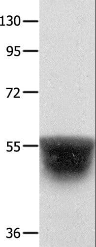 Polyclonal Rabbit anti-Human KCNA1 / Kv1.1 Antibody (IHC, WB)