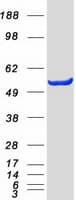 Human GPT / Alanine Transaminase Protein (Recombinant Myc-DDK (Flag))