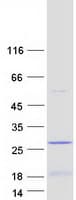 Human LIN52 Protein (Recombinant Myc-DDK (Flag))