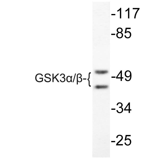 Polyclonal Rabbit anti-Human GSK3A / GSK3 Alpha Antibody (Gly273/120, IHC, WB)