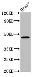Polyclonal Rabbit anti-Human LASS3 Antibody (WB)