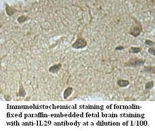 Polyclonal Rabbit anti-Human IFNL1 / IL29 Antibody (aa23-200, IHC, WB)