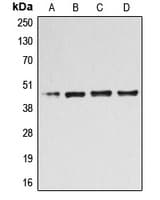 Polyclonal Rabbit anti-Human B4GALT3 Antibody (Internal, IHC, WB)