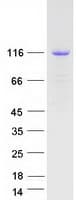 Human CSF2RB / CD131 Protein (Recombinant Myc-DDK (Flag))