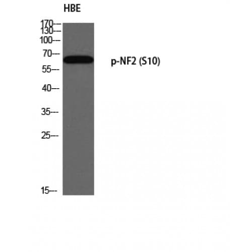 Polyclonal Rabbit anti-Human NF2 / Merlin Antibody (1-80 aa, IHC, WB)