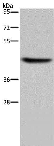 Polyclonal Rabbit anti-Human HSD3B1 Antibody (IHC, WB)