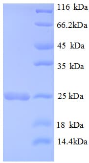 Rat HRAS / H-Ras Protein (Recombinant His)