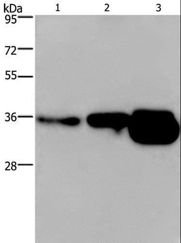 Polyclonal Rabbit anti-Human CUEDC2 Antibody (IHC, WB)