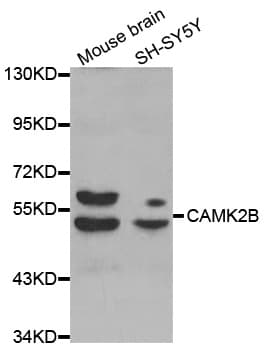 Polyclonal Rabbit anti-Human CAMK2B / CaMKII Beta Antibody (IHC, WB)