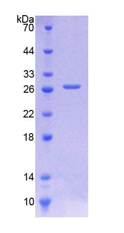 Human CTSD / Cathepsin D Protein (Recombinant His)