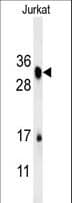 RSPO4 Antibody (aa199-228)