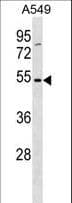 TM6SF1 Antibody (aa40-68)