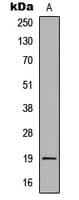 BAFF Receptor / CD268 Antibody (Internal)