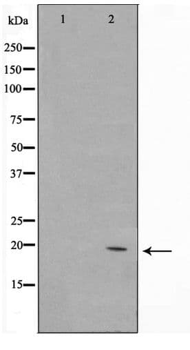 NTPCR / C1orf57 Antibody