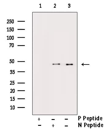 DUSP1 / MKP1 Antibody (phospho-Ser296,pSer318)